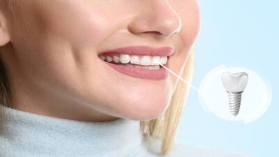 Teeth Whitening in the UK: A Comprehensive Guide